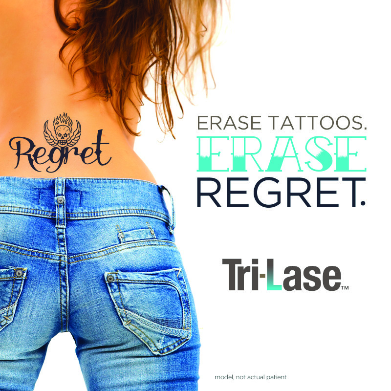 tattoo removal in san antonio texas best tatto 2017 tattoo removal in san antonio texas best tatto 2017