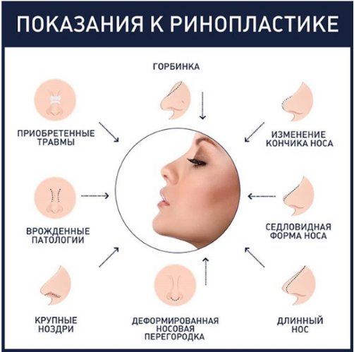 Ольга Дроздова до и после пластики. Фото в молодости, как выглядит сейчас, как изменилась