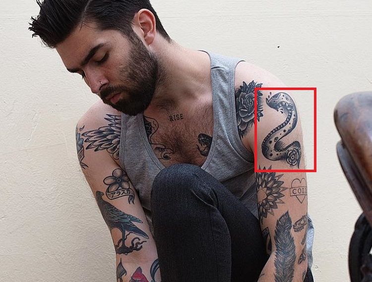 Chris John Millington-Shoulder-Arm