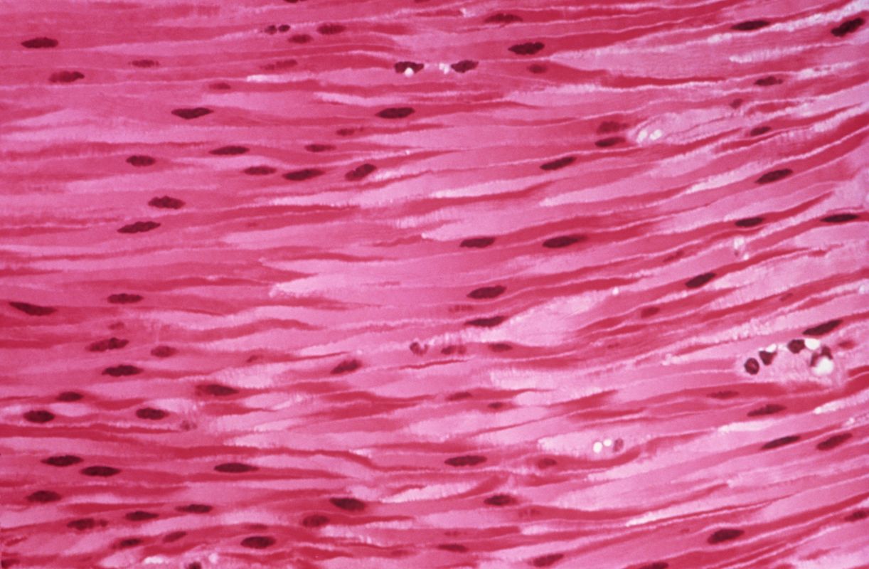 Muscle Cells - Ms. Jung's Biology World!