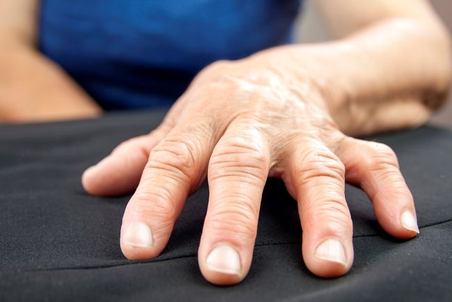 Sindrom Marfan Gejala Penyebab Dan Mengobati Alodokter