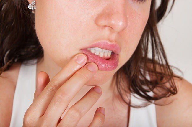 Obat Acyclovir Oral untuk infeksi virus Obat Acyclovir Oral untuk infeksi virus
