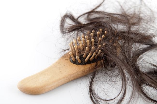 Inilah Penyebab Rambut Rontok Berlebihan - alodokter