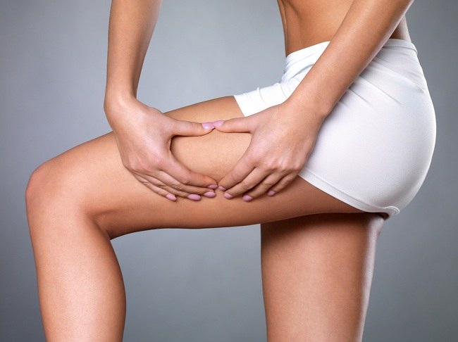5 cara menghilangkan selulit untuk kulit lebih mulus - alodokter