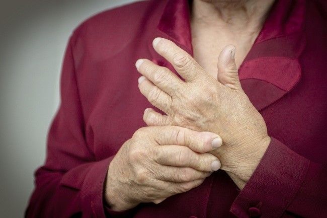 Rheumatoid Arthritis - Gejala, penyebab dan mengobati - Alodokter