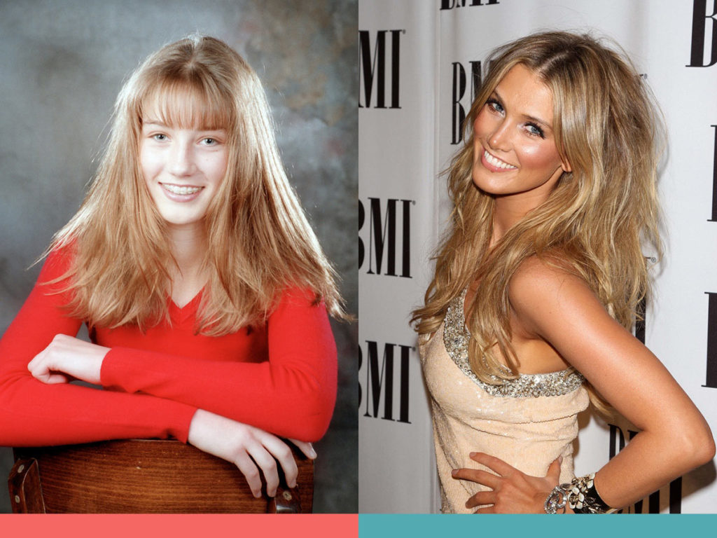 Before and After