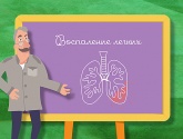 Воспаление легких Воспаление легких