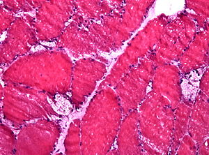 Pompe vacuoles.jpg