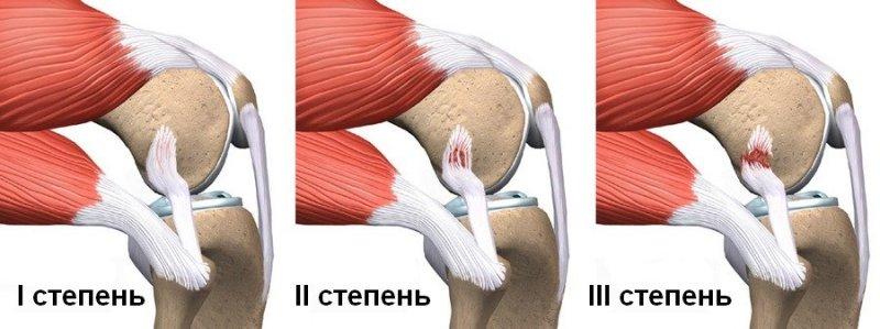 Ступінь розтягування