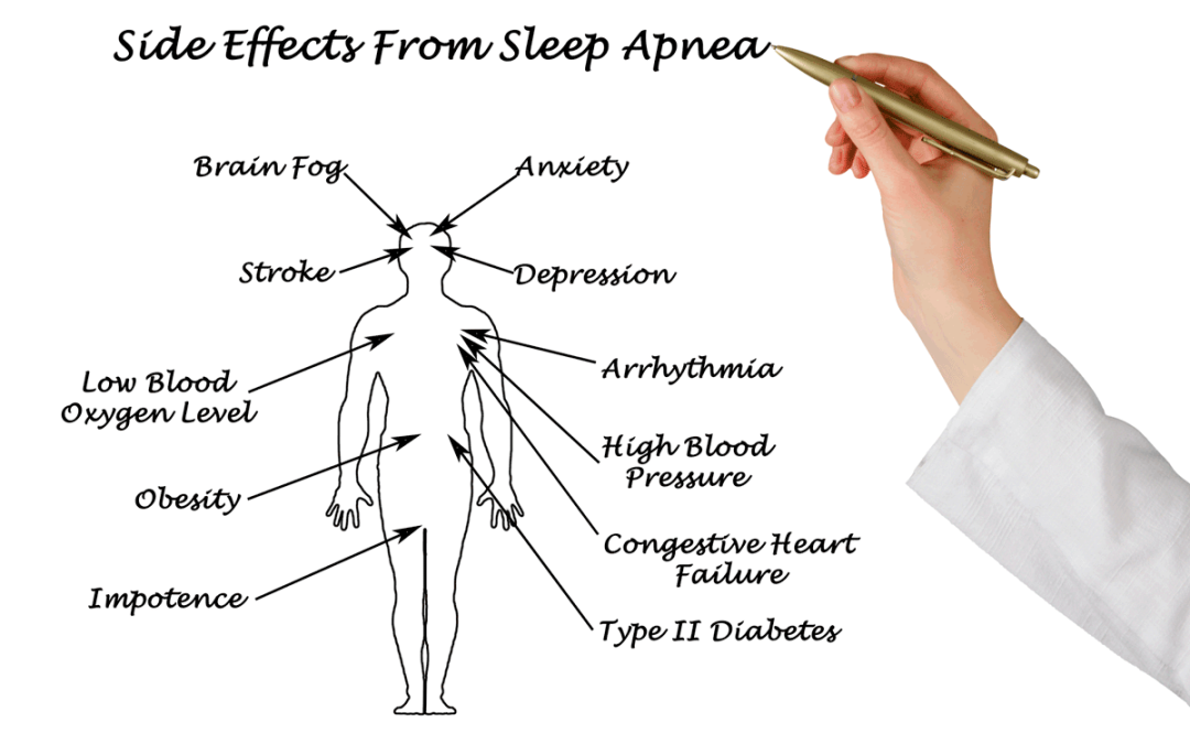 How Much Does Sleep Apnea Actually Cost Us?