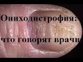 Ониходистрофия: что говорят врачи
