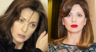 Ольга Дроздова до и после пластики