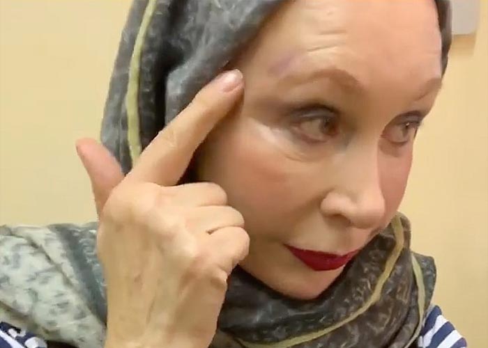 Татьяна Васильева с травмой головы