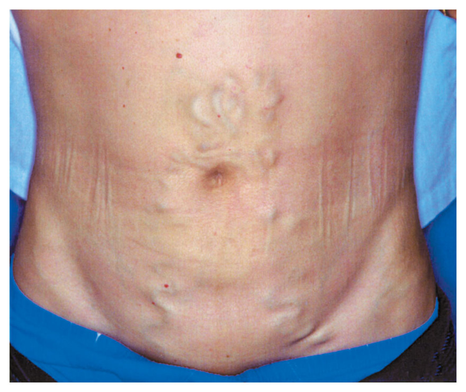 case study image