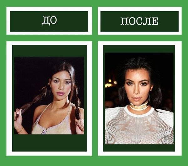 Как на самом деле Ким Кардашьян сделала такую фигуру и лицо: тайны звезды и фото до - после Как на самом деле Ким Кардашьян сделала такую фигуру и лицо: тайны звезды и фото до - после