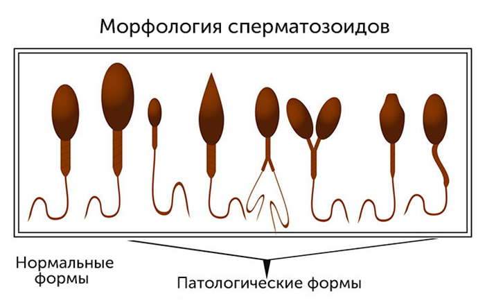 Морфология сперматозоидов