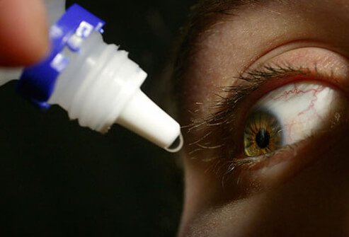 Close-up of a man applying drops to the eye.