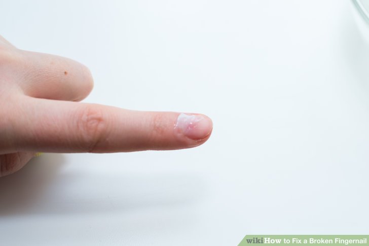 Image titled Fix a Broken Fingernail Step 22