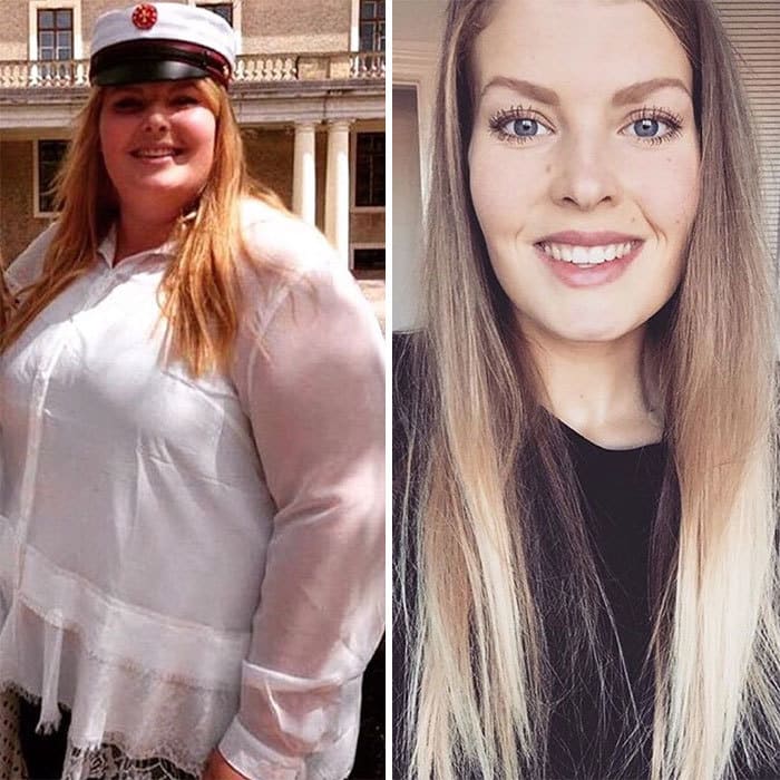 My Sister Before And After Losing Over 168 Lbs In 11 Months