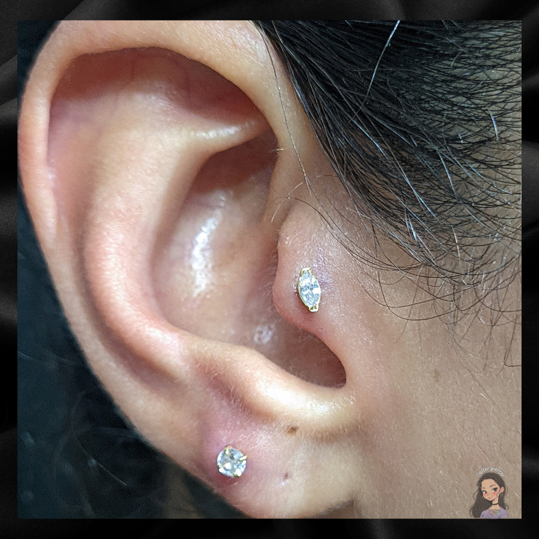 gota tragus