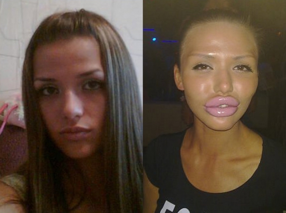 Davydova
