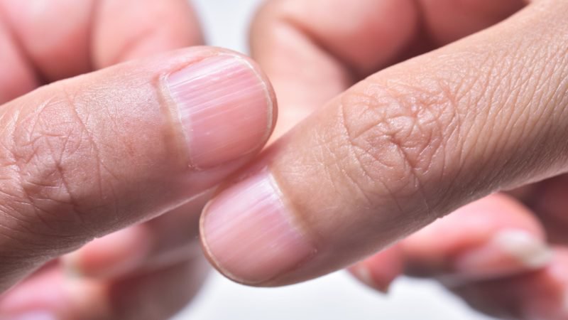 nails nail hands ridges