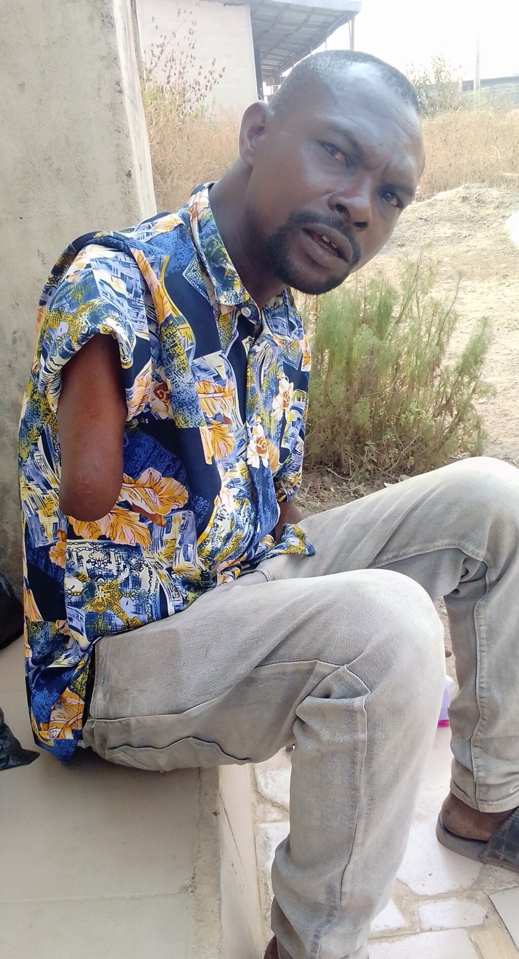 Oyo Amputees Turn Road Hogs to Survive