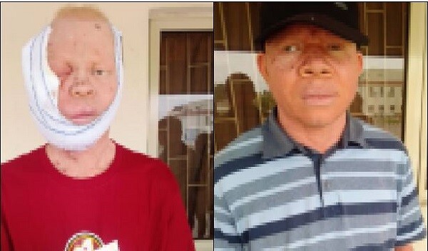 Damned for Their Color