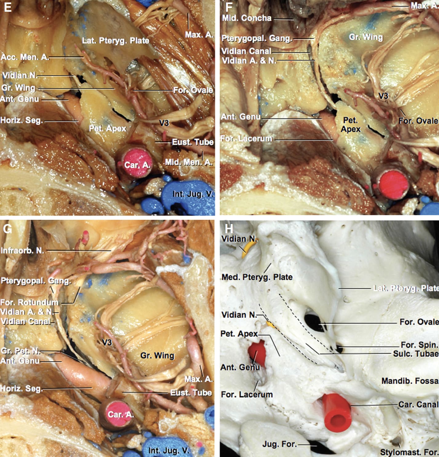 Inferior View of a Stepwise Dissection of an Axial Section of the
