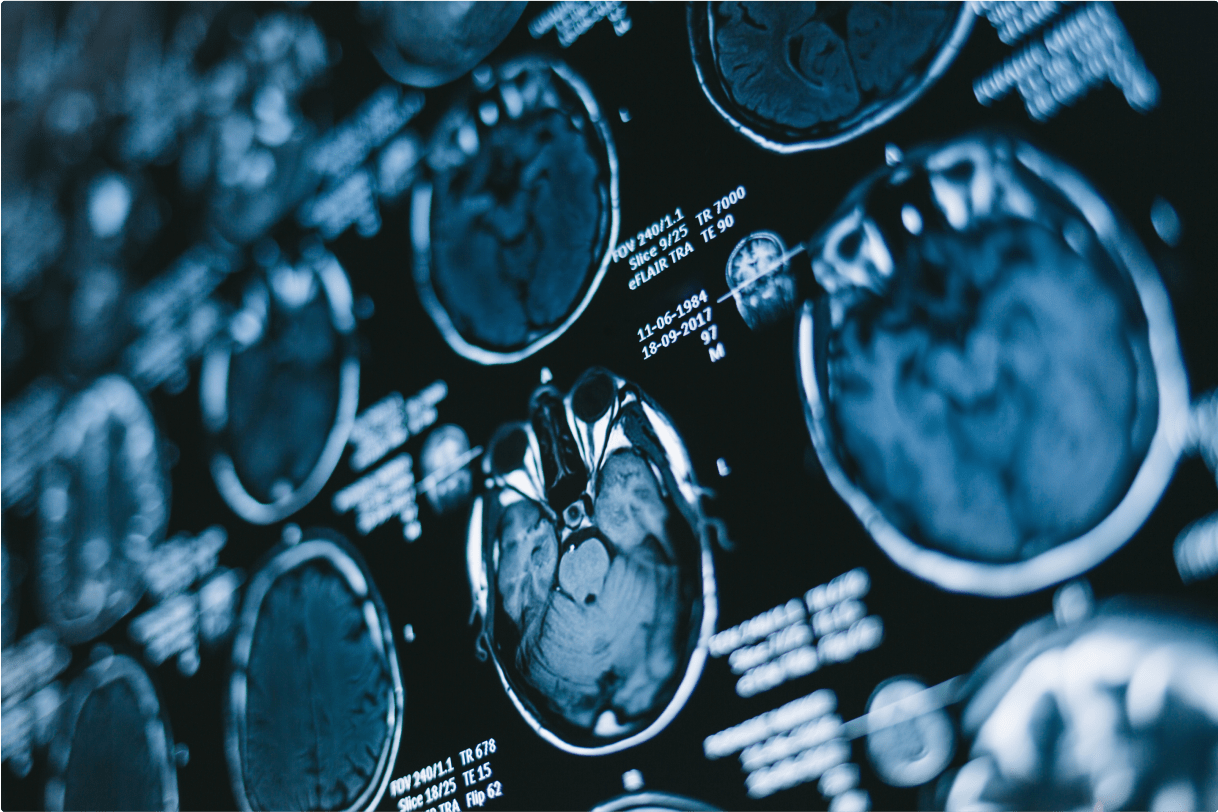The Neurosurgical Atlas, by Aaron Cohen-Gadol, M.D.