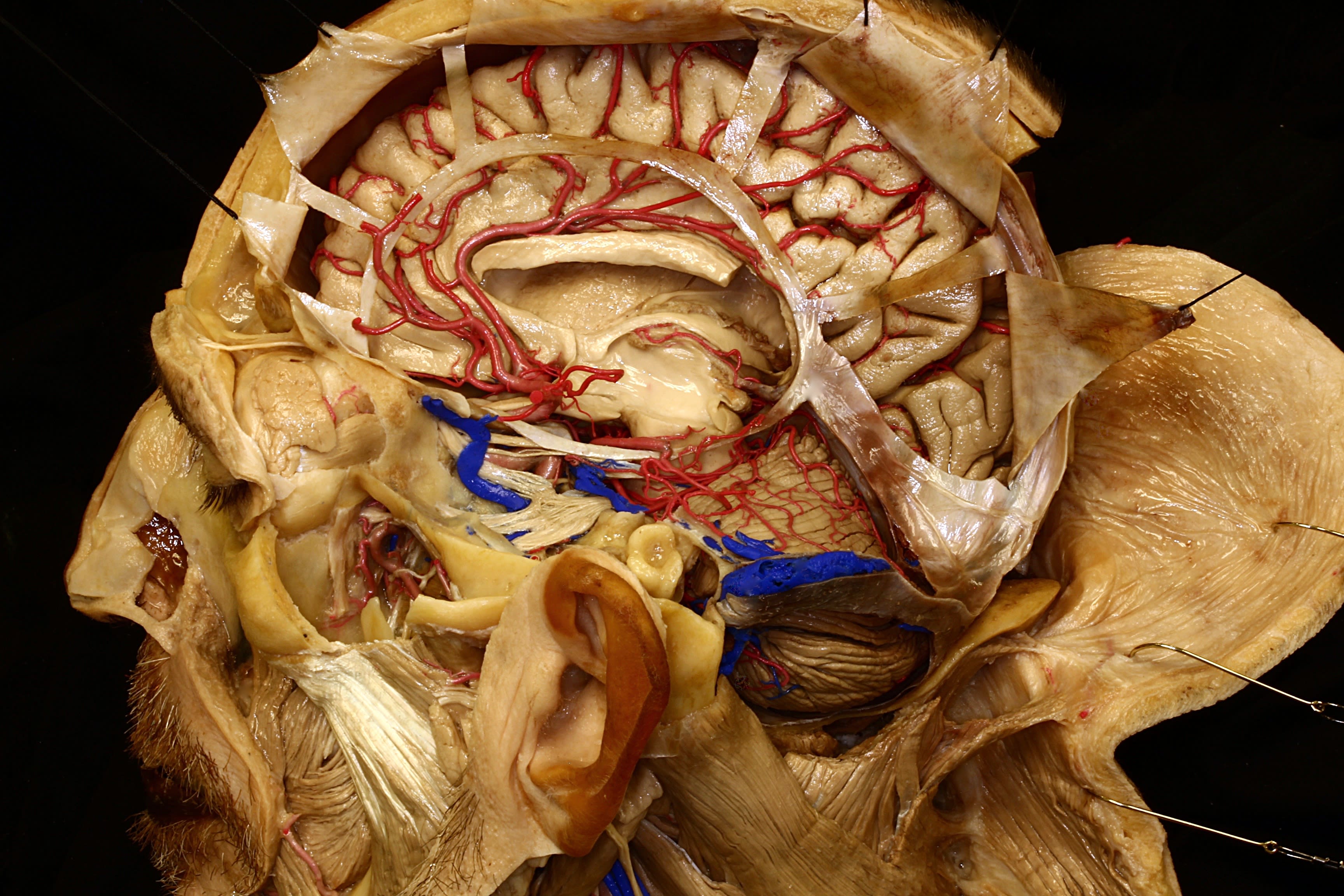 Neuroanatomy: An Introduction | Neuroanatomy | The Neurosurgical Atlas