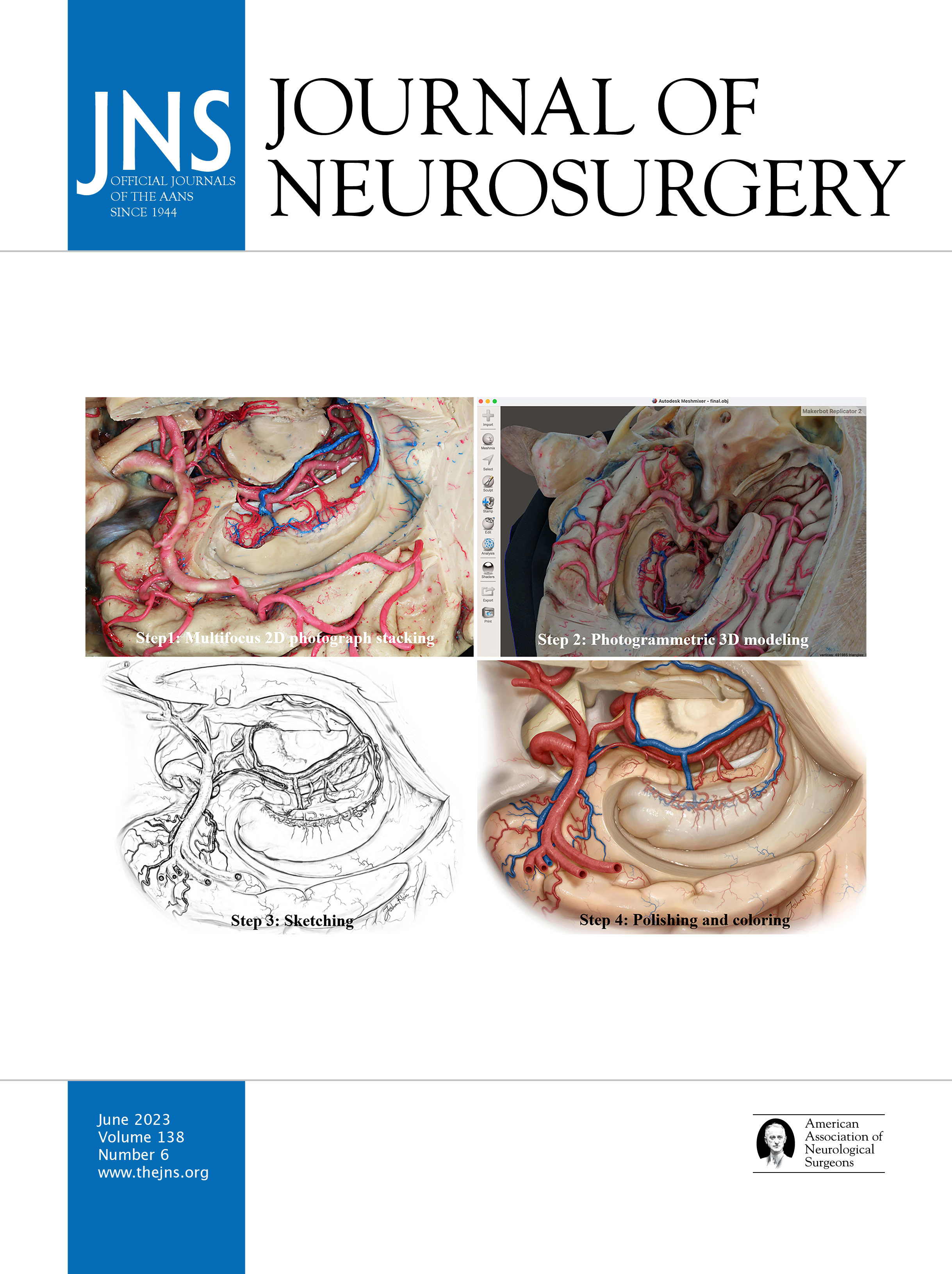Trending Articles: June 2023 | Cohen Collection | Volumes | The Neurosurgical Atlas Trending Articles: June 2023 | Cohen Collection | Volumes | The Neurosurgical Atlas
