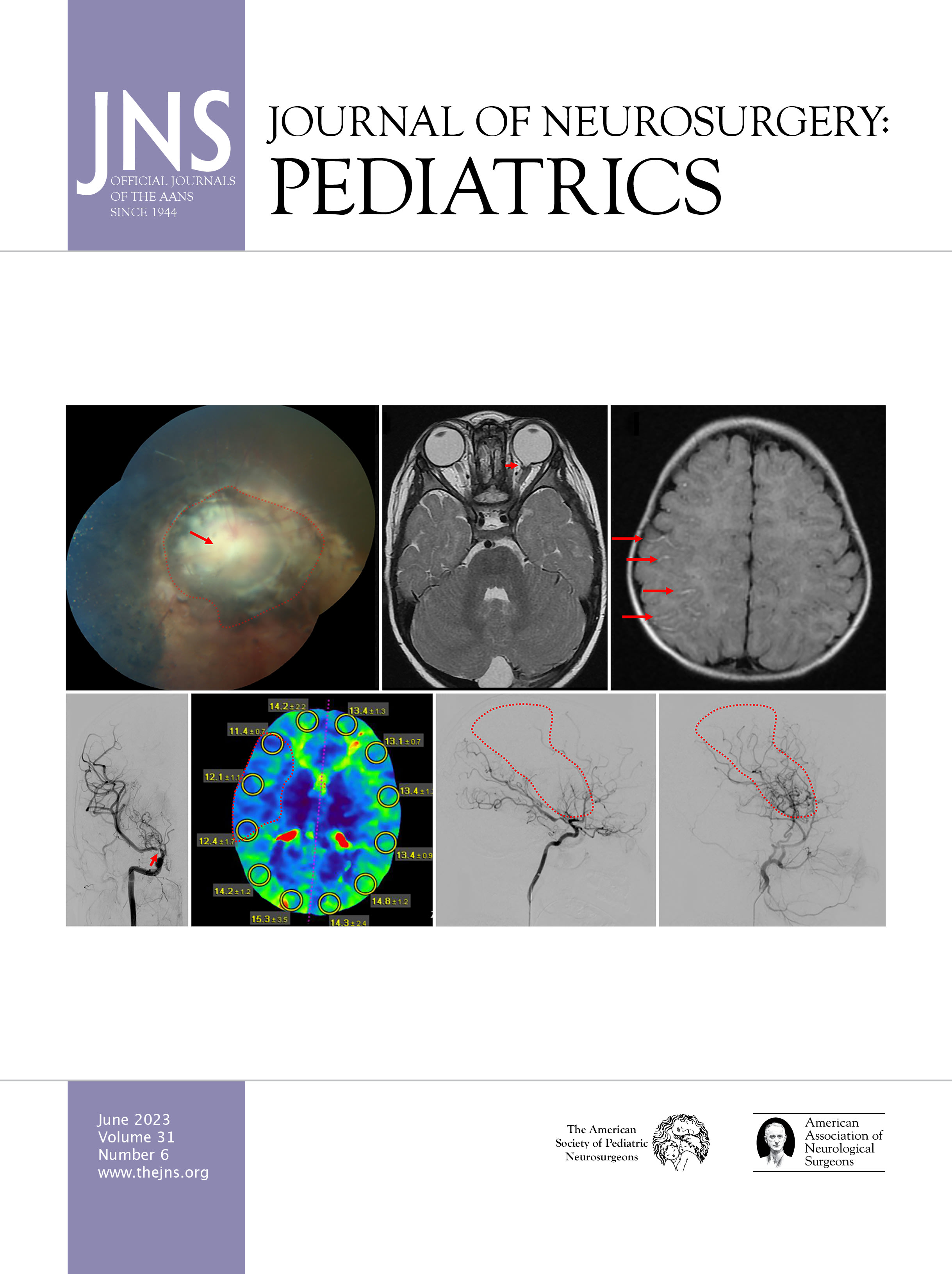 Atlas of Pediatric Neurosurgery: 9780721651385: Medicine