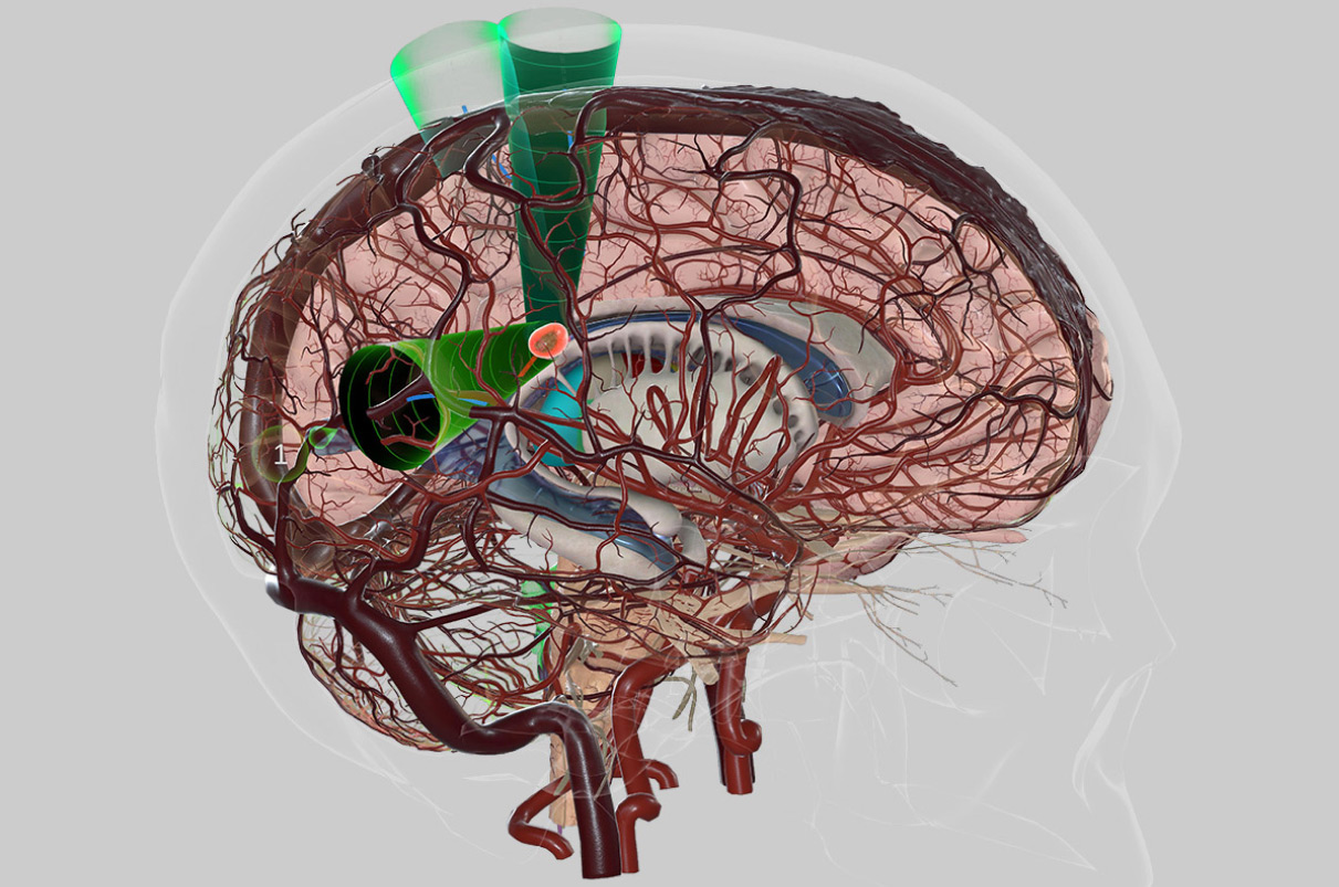 健康・医学 Micro-neurosurgical Atlas The Neurosurgical Atlas, by Aaron Cohen-Gadol, M.D.