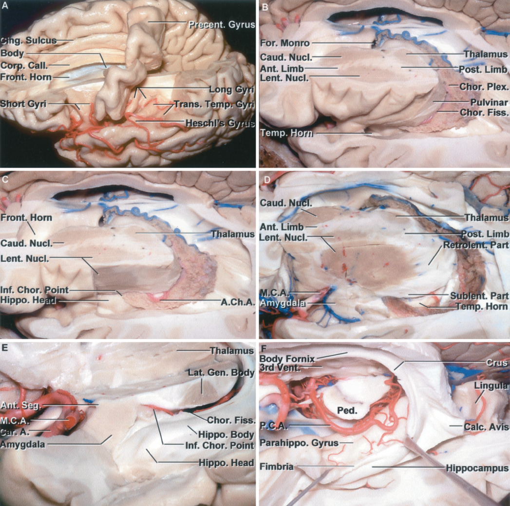 Stepwise Dissection of the Central Core of the Hemisphere A-F