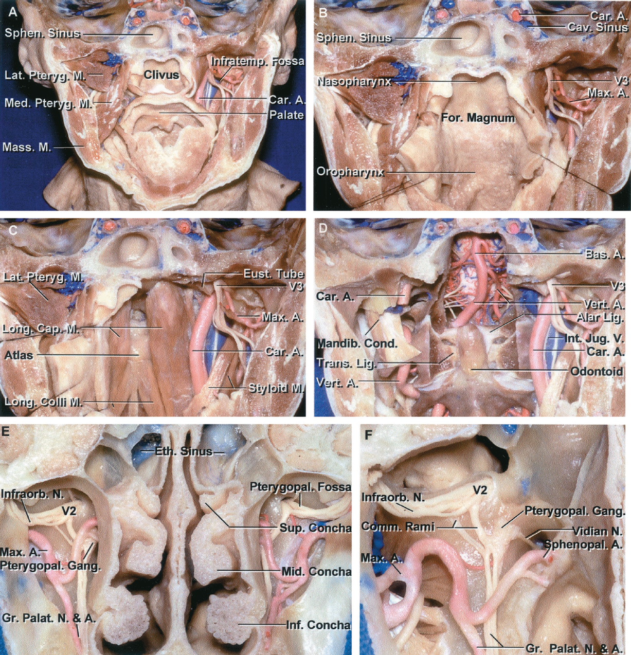 Anterior View of Stepwise Dissection of a Cross Section Showing