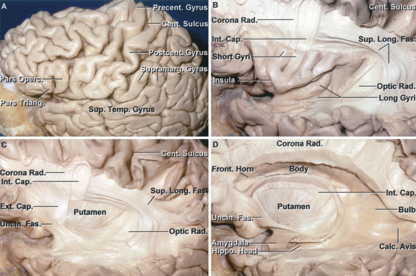 大脳白質解剖入門 = An Introduction of Fiber Dis… ヨドバシ.com - 大脳白質解剖入門（An Introduction of Fiber