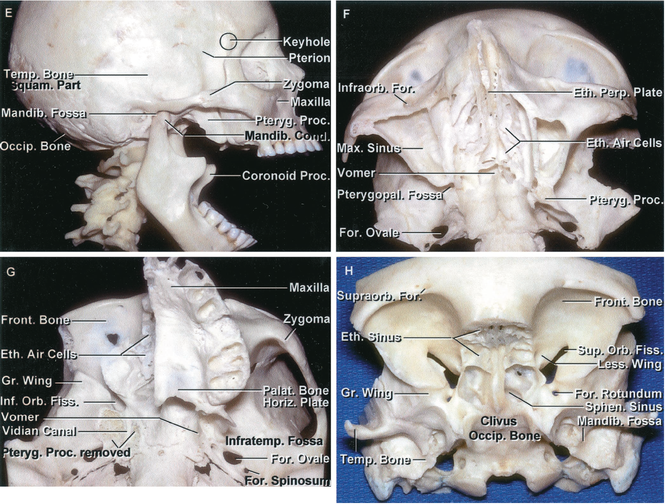 Operative Cranial Neurosurgical Anatomy: 9781626232167