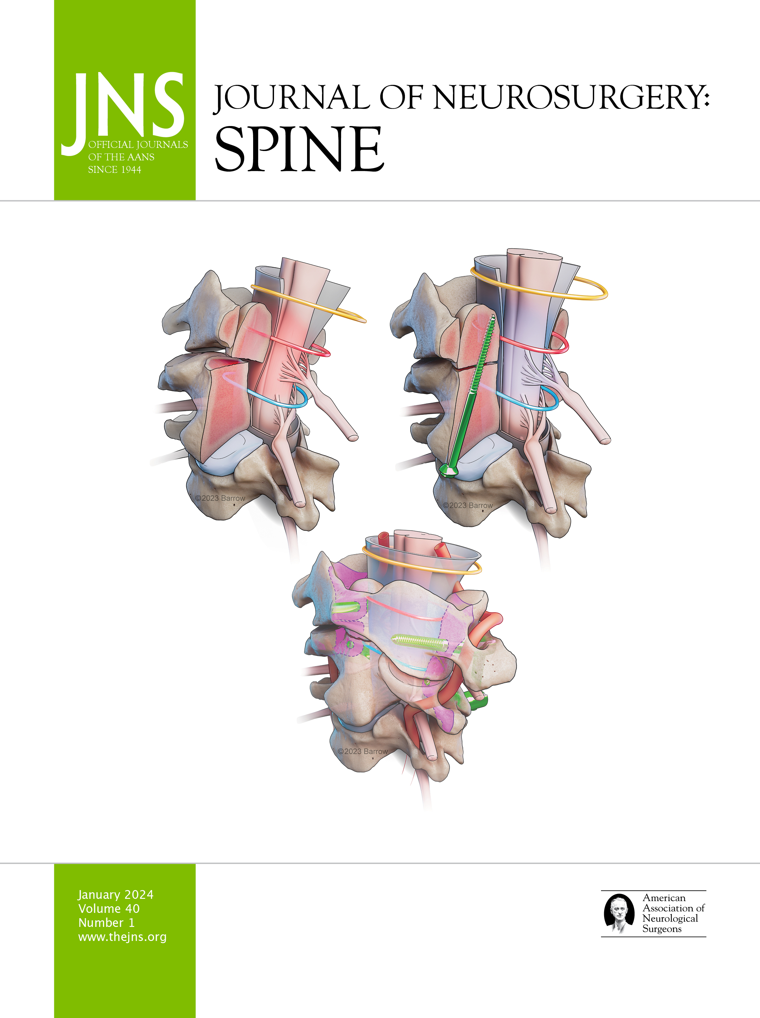 新 NS NOW Neurosurgical ReOperations Brain Surgery Archives | Sierra Neurosurgery Group