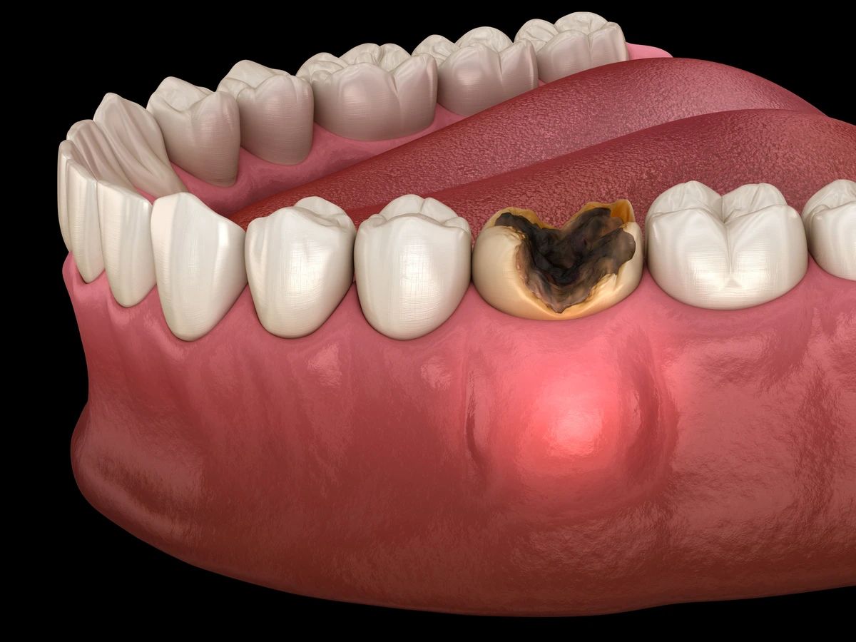 Testimony: God Healed Me of My Toothache