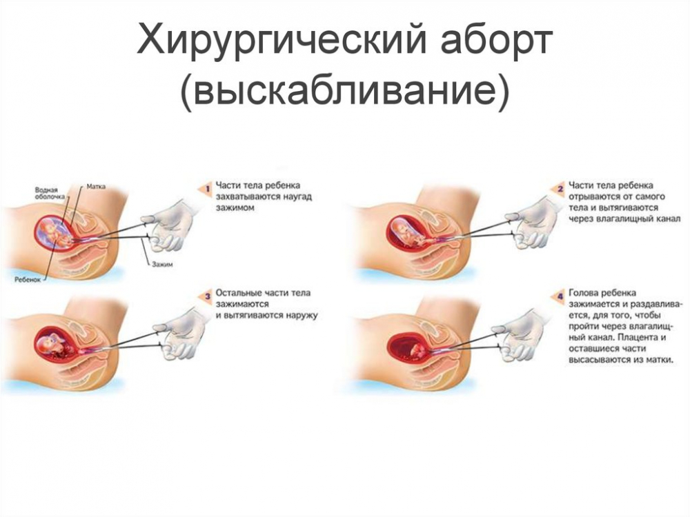 С Какой Недели Нельзя Секса