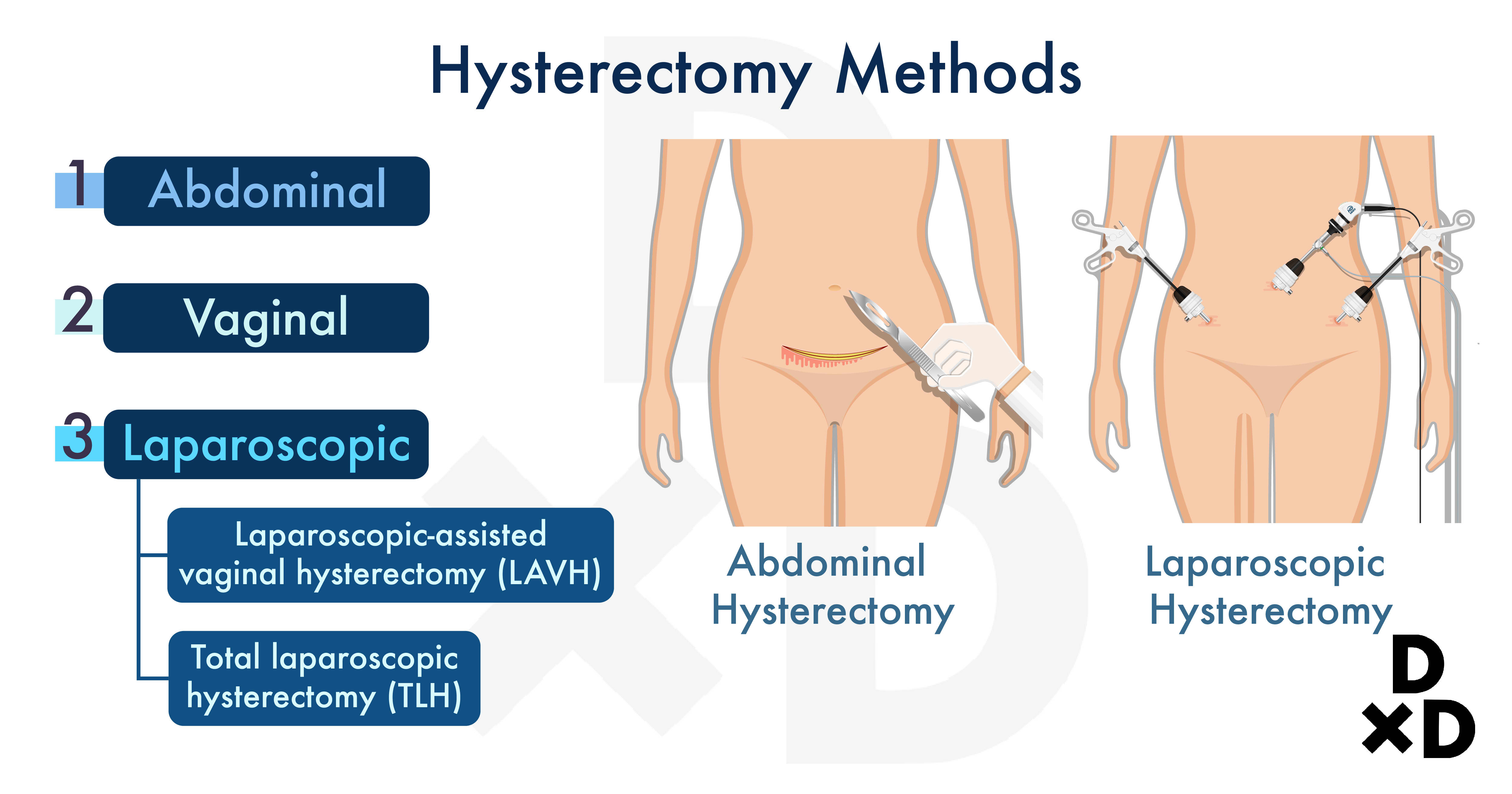 The Ultimate Guide To Hysterectomy In Singapore Human