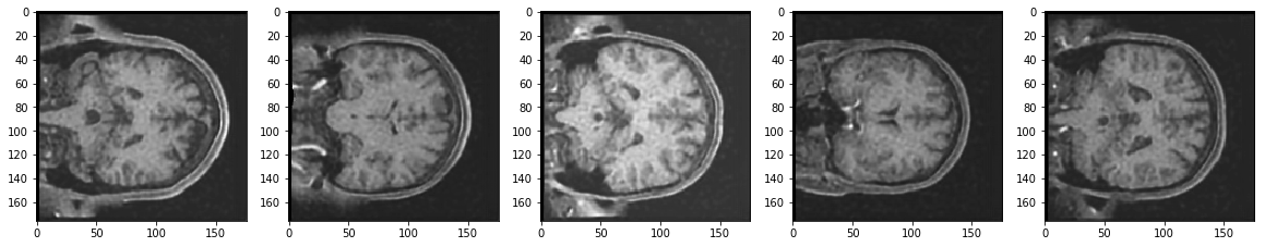 Reconstruction of Noisy Test Images