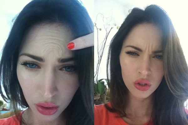 megan fox botox