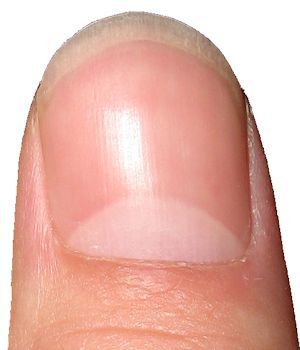 Healthy fingernail picture