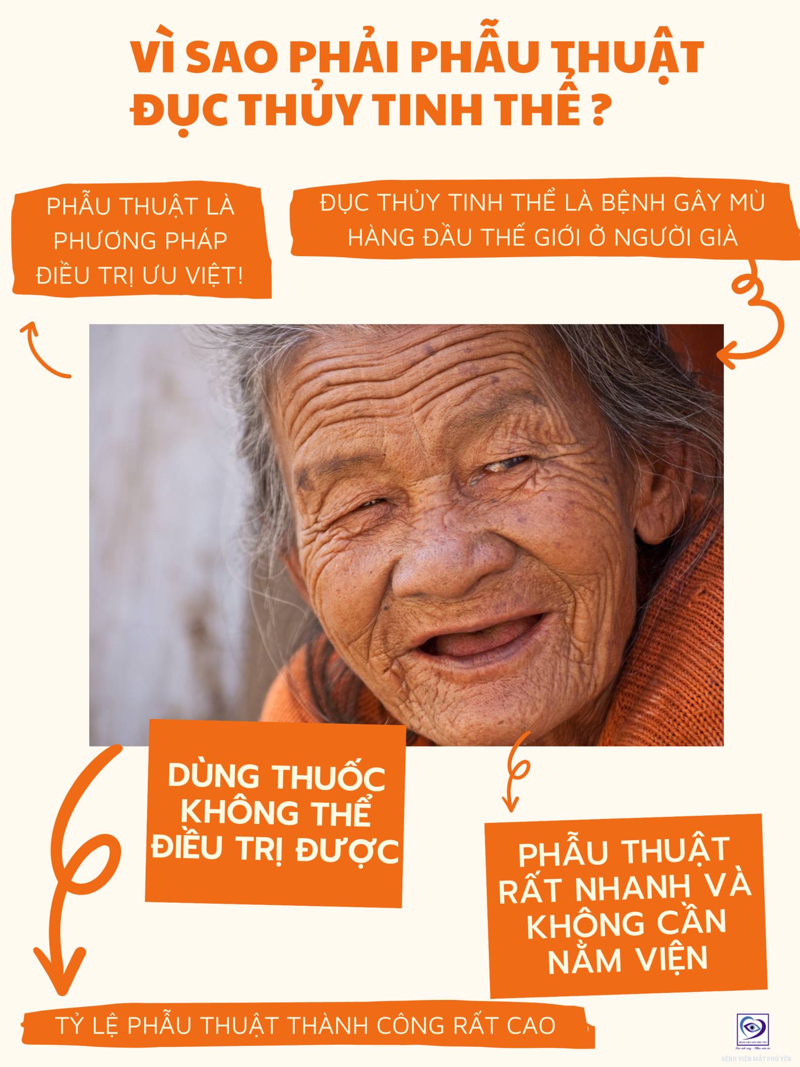 Đục thủy tinh thể