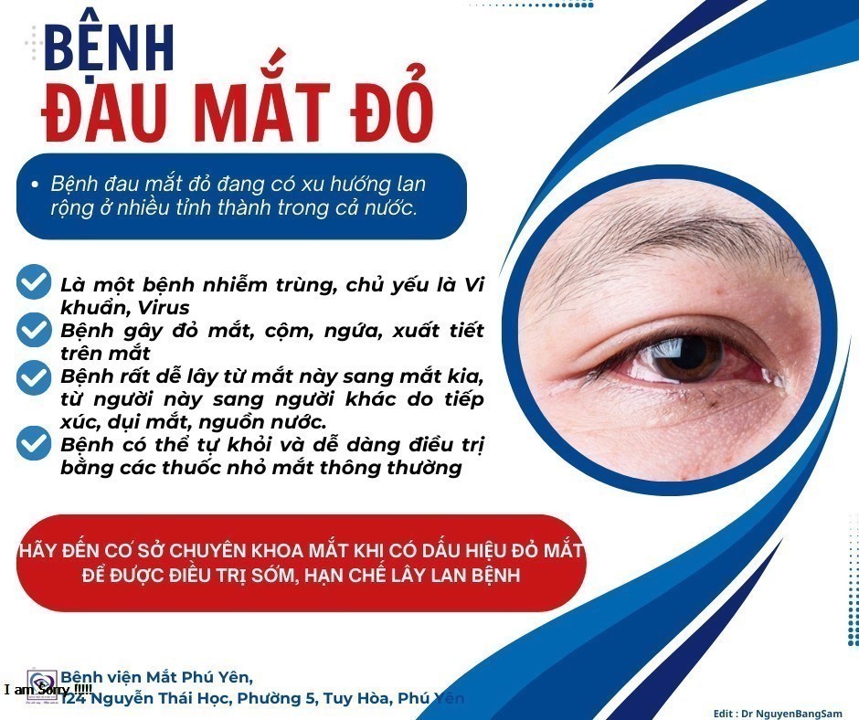 Đau mắt đỏ