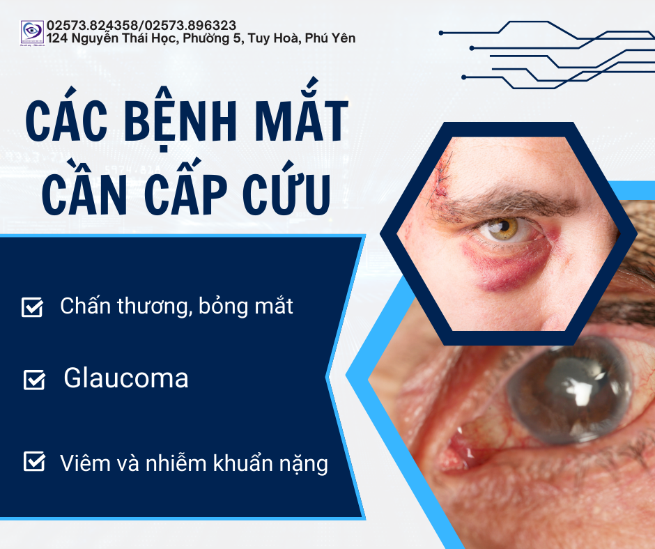 Các bệnh mắt cần cấp cứu