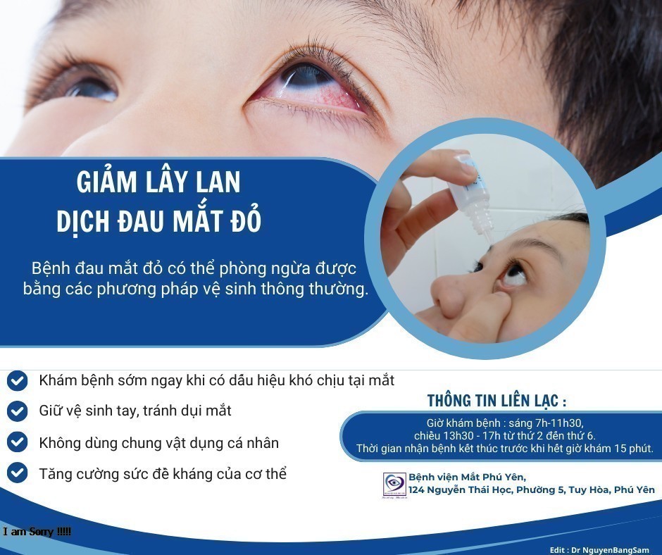 Phòng bệnh đau mắt đỏ