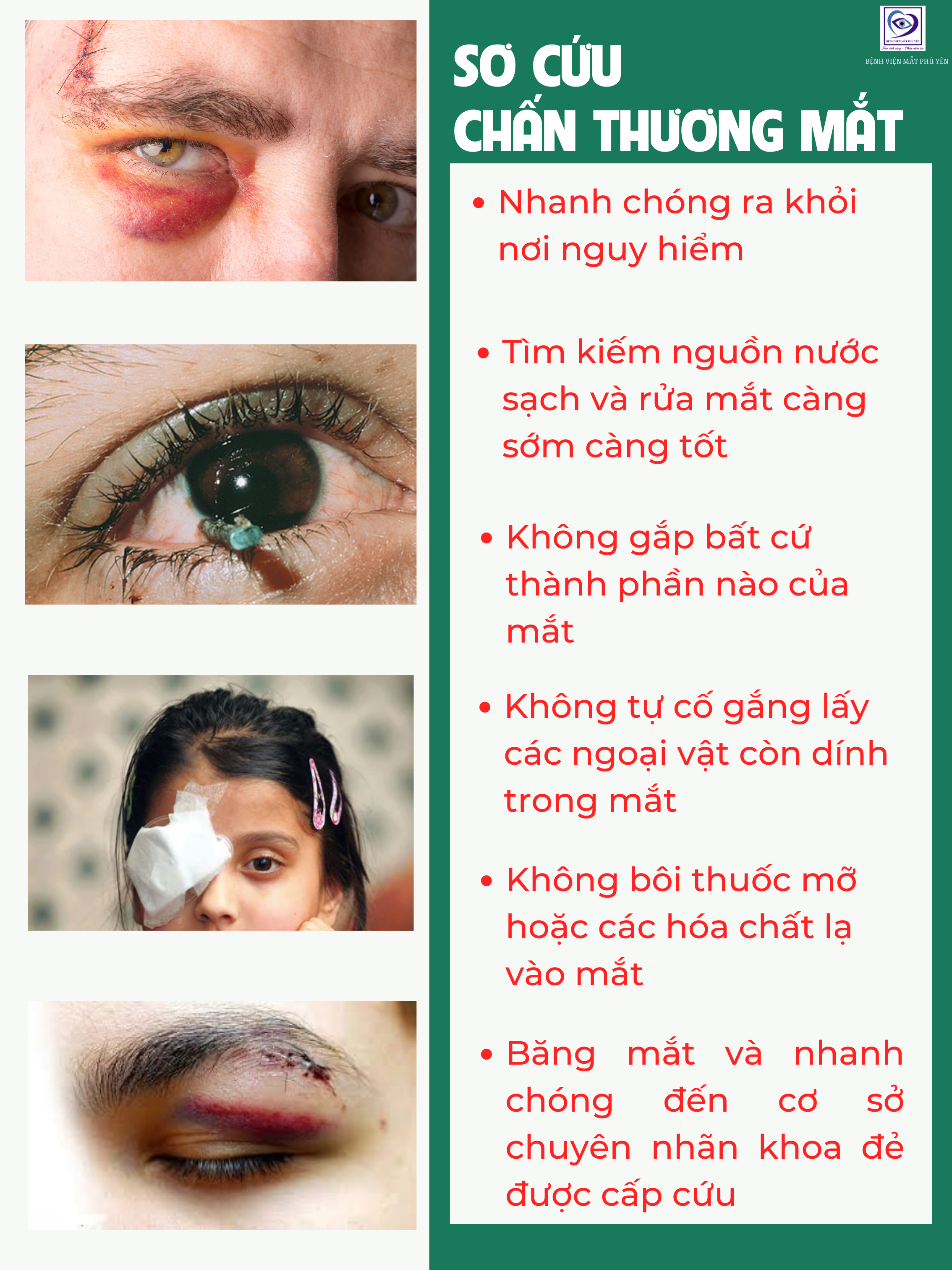 Sơ cứu chấn thương mắt